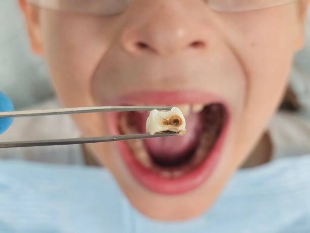 Best Emergency Treatment for Oral Infections in Gibson, AR